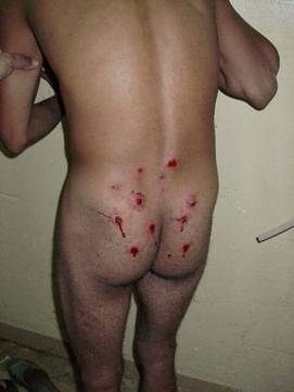 An Iraqi prisoner's back riddled with bullet holes from a shotgun.