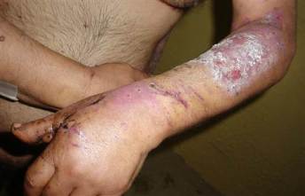 Another shot of the injuries sustained by an unnamed inmate.